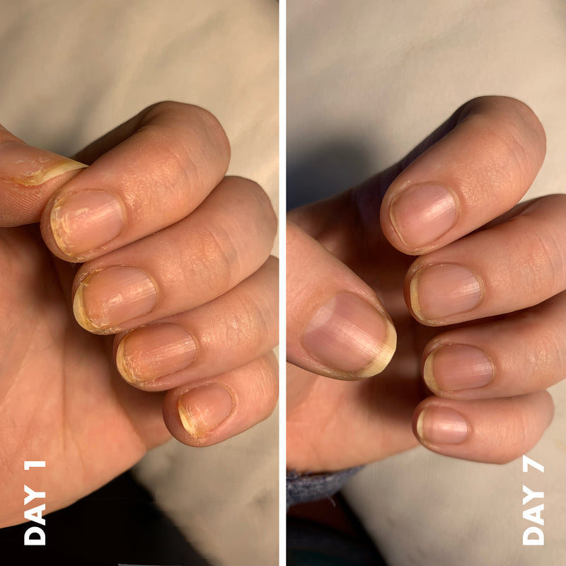 Comparison of nails on day 1 and day 7 showing improvement using Nail Strengthener for stronger, healthier nails