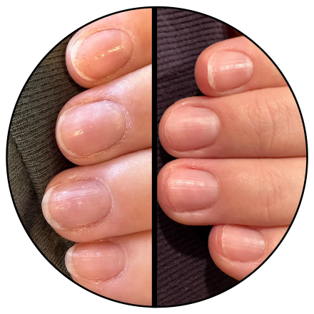 before of rough flaky cuticle and after of smooth cuticles