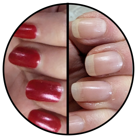 before of nails with red polish and after of healthy looking unpainted nails