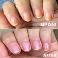 The Nail Brightener before and after thumbnail